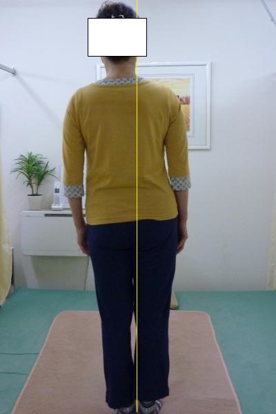 腰部と足部裏の姿形写真