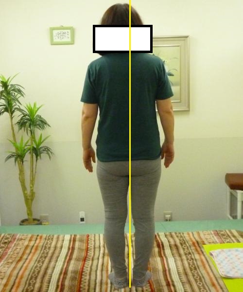 腰痛 和楽堂健姿形矯正院